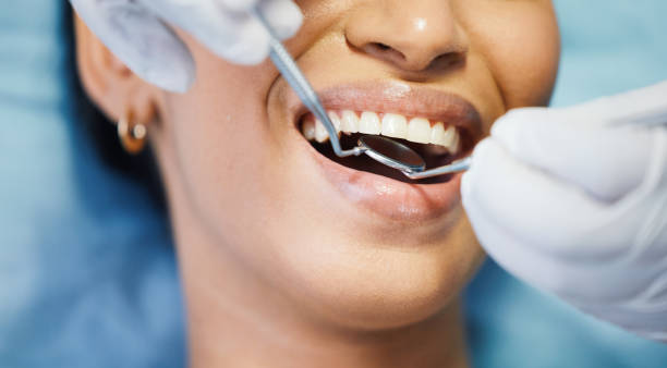 Best Emergency Dentist for Lost Fillings or Crowns in Bedford Hills, NY
